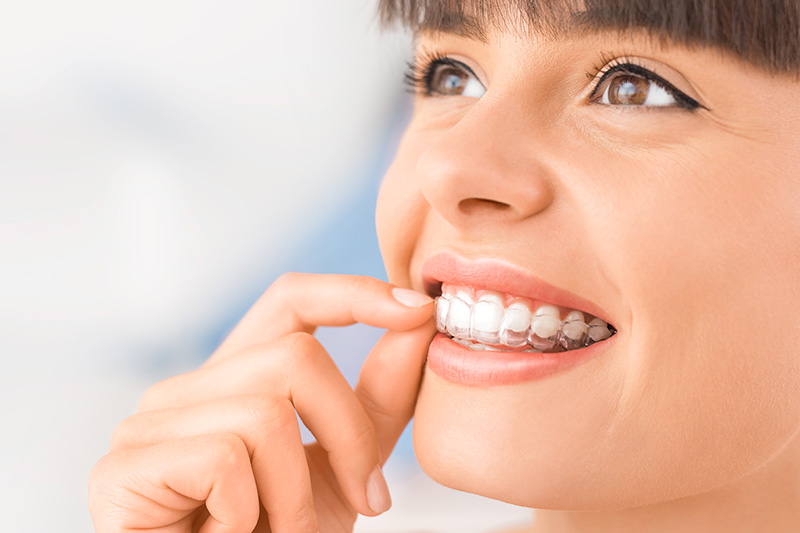 Quality Dental Treatments in San Luis Obispo