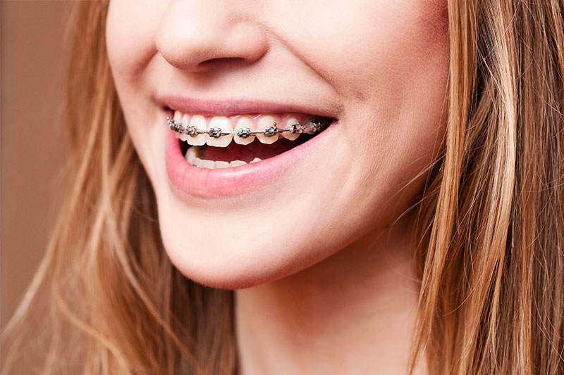 Orthodontics in San Luis Obispo